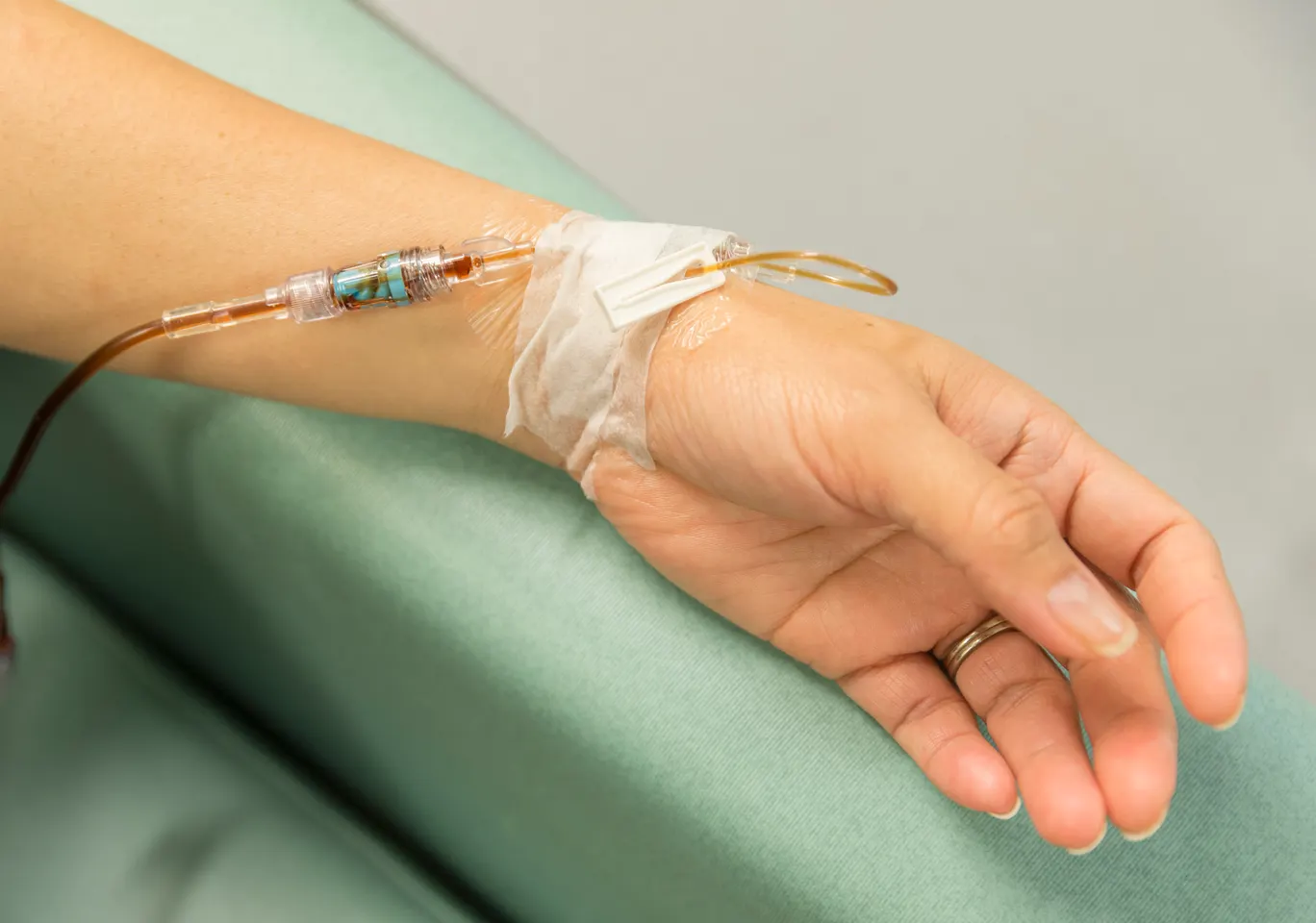 Kroplówki witaminowe Sobótka: dłoń z wenflonem i linią infuzyjną na podkładzie