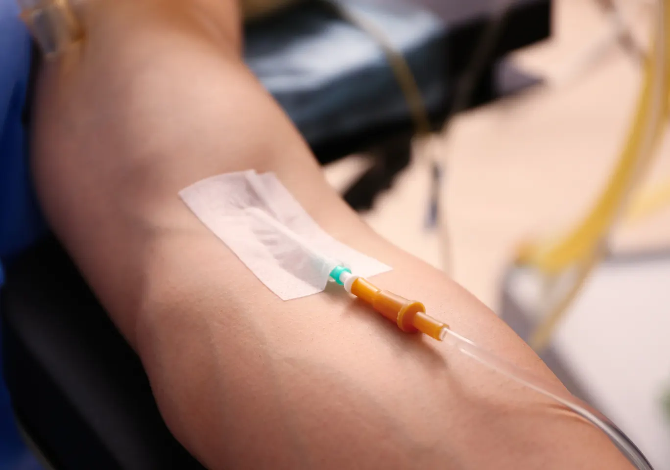 Kroplówki witaminowe Brzeg Dolny: przedramię z kaniulą i przezroczystym opatrunkiem