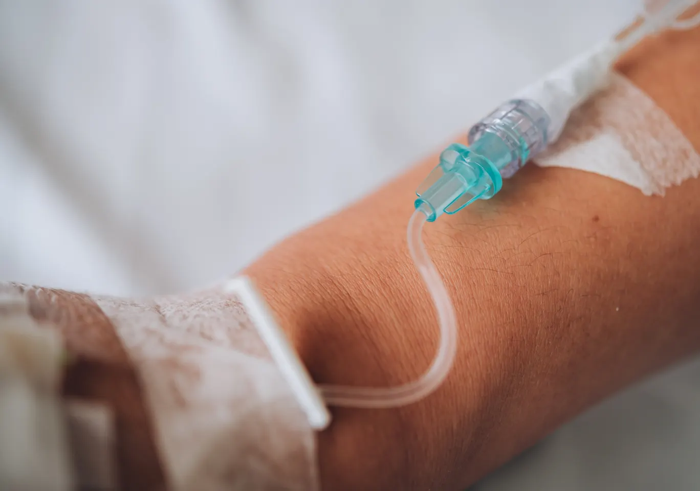Kroplówki witaminowe Kąty Wrocławskie: wenflon oklejony na przedramieniu podczas wlewu